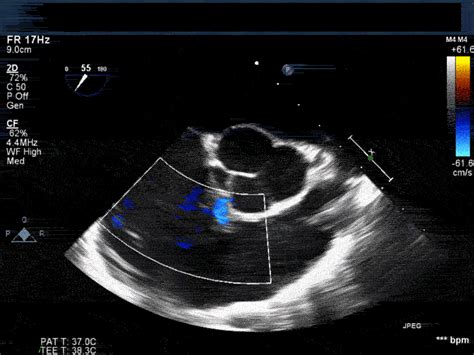 Interesting Cases Duke Department Of Anesthesiology