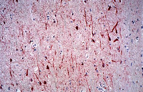 What is your nervous system? Free picture: photomicrograph, human, central, nervous ...