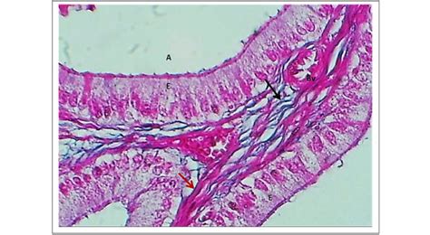 Magnified Section Of Alveoli Of Vesicular Gland In Domestic Bull Shows
