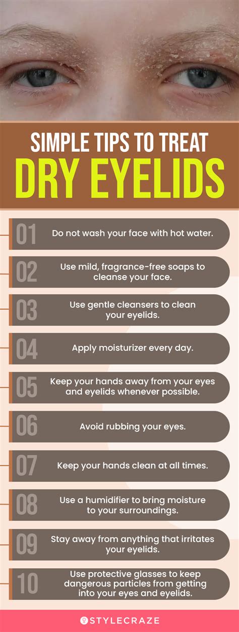 Dry Eyelids Causes Symptoms And Treatment