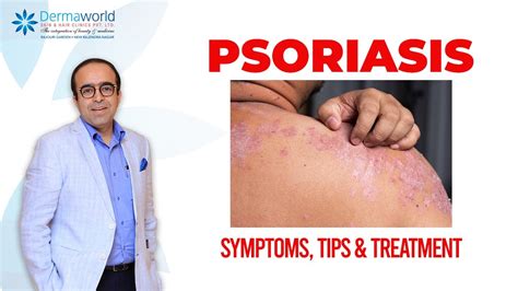 Psoriasis Symptoms Tips And Treatment The Best Psoriasis