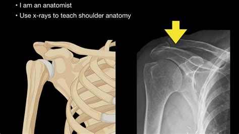 Anatomy Of Shoulder X Rays Youtube