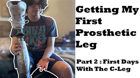 Getting My First Prosthetic Leg Part 2 First Days With The C Leg
