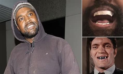 Kanye West Has Had All His Teeth Extracted And Replaced With More