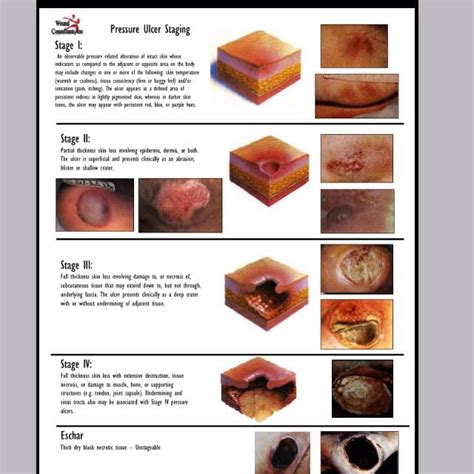 Wound Stages Keep Calm And Nurse On Pinterest