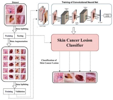 Diagnostics Free Full Text An Efficient Deep Learning Based Skin