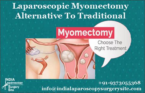 Advanced Myomectomy And Fibroid Surgery In India At Low Cost Fibroid Surgery Fibroids Surgery