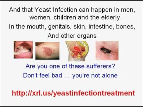 How do i know if i have a vaginal yeast infection? Easy Yeast Infection Treatment Home Remedy! - YouTube