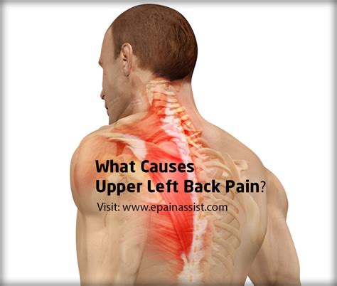 We've outlined the main causes of pain under the left rib cage so you can figure out what's wrong. Upper Left Back Pain|Causes|Symptoms|Treatment|Diagnosis