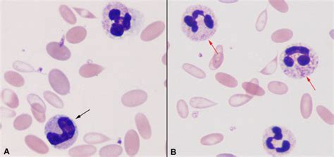 Toxic Changes Of Neutrophils In An Alpaca Eclinpath