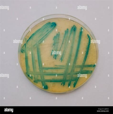 Photo Of Growth Of Green Bacterial Colonies On Nutrient Agar Stock