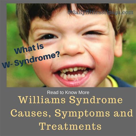Williams Syndrome Symptoms Causes And Treatment Images And Photos Finder