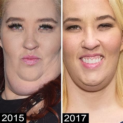How Did Mama June Lose Weight See Her Transformation