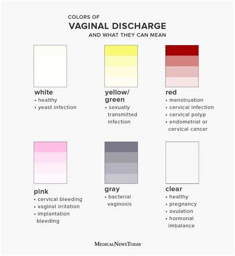 Vaginal Discharge Normal Vs Not Normal