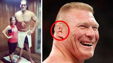10 Wrestlers Who Suffered With Illnesses And Body Deformities Wwe Etc