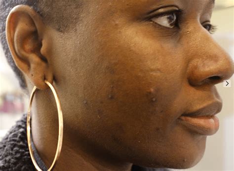 13 Skincare Products Every Black Girl Should Use To Get Rid Of Dark