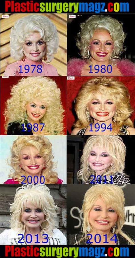 Dolly Parton Without Makeup And Wig Mugeek Vidalondon