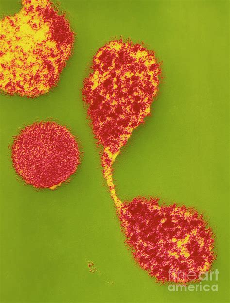 Coloured Tem Of Mycoplasma Pneumoniae Photograph By Dr Kari Lounatmaa