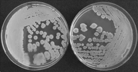 Candida Krusei Left And Candida Lambica Right Culture On Bbl