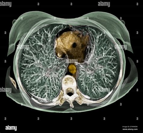 Chest Anatomy 3d Ct Scan Stock Photo Alamy