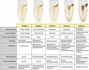 Referred Tooth Chart Best Picture Of Chart Anyimage Org