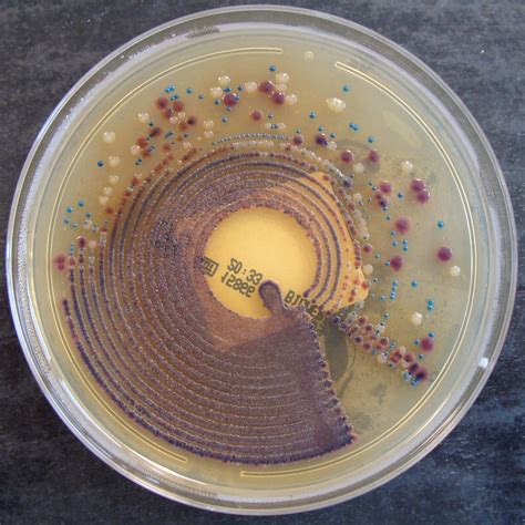 Mixed Culture 2 Urine Cultures On Chromid Cps Mixed Cult Flickr