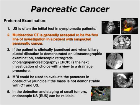 Ppt Pancreatic Cancer Powerpoint Presentation Free Download Id3295800