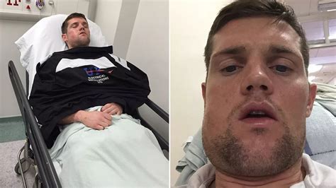 Footballer Left With Broken Jaw After Pitch Brawl Banned For Spitting At Alleged Attacker