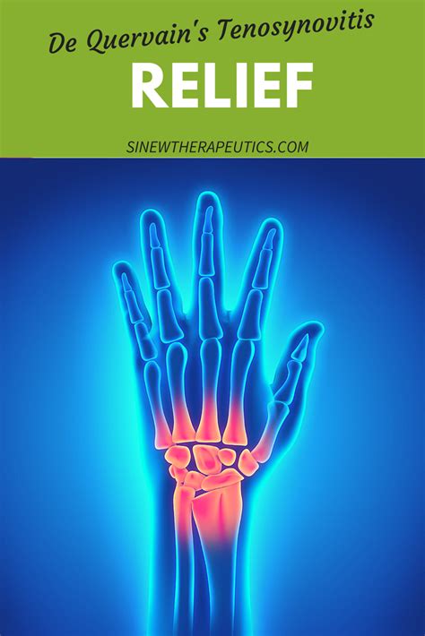 In de quervain's tenosynovitis, thickening and edema result in restriction of the normal gliding of the patients with de quervain's tenosynovitis typically present with dorsoradial wrist pain, limitation of surgical release is necessary if these treatment regimens fail. The synovial sheaths may also be inflamed. Learn more ...