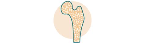 Osteoporosis And Metabolic Bone Disorders — Sydney Endocrinology