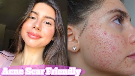 Acne Scar Friendly Makeup Tutorial How I Cover My Acne Scars Natural