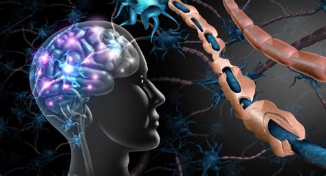 Neurology Multiple Sclerosis Symptoms Diagnosis And Treatment