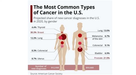 Health Infographics The Most Common Types Of Cancer In Us By Gender