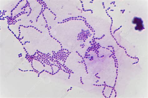 Streptococci Bacteria