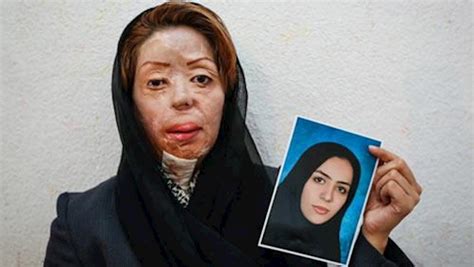 جنایت اسیدپاشی روی صورت زنی جوان در تهران