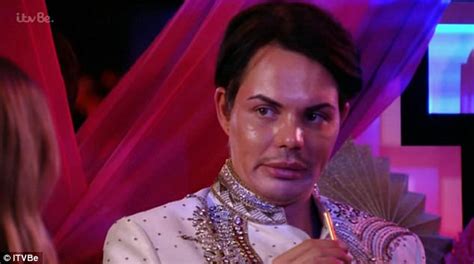 Towie S Bobby Norris Nose Job Divides Fans Daily Mail Online