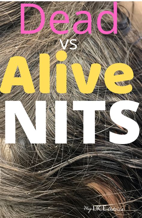 After about 20 minutes, rinse out the dye and comb your hair with the boiled lice comb. Dead vs Live Nits: Color of Lice Eggs | Lice eggs, Louse ...