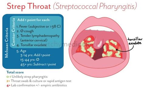 Streptococcal Pharyngitis Pharyngitis Pediatric Nurse Practitioner