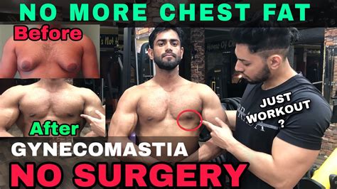 Remove Gynecomastia Chest Fat Workout Man Chest Fat Burning Workout