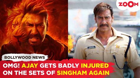 Ajay Devgn Gets Injured While Shooting An Intense Action Sequence For