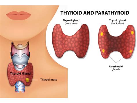 Thyroid Surgery Thyroidectomy Fort Worth ENT Sinus