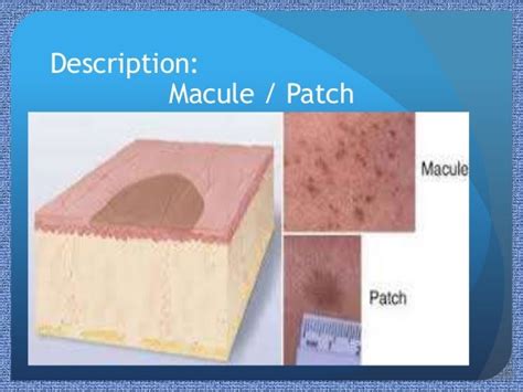 Paediatric Rashes