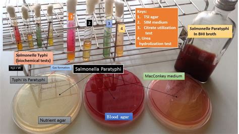 Enterica is the type species and is further divided into six subspecies that include over 2. Salmonella: Introduction, Pathogenesis, Lab Diagnosis and ...