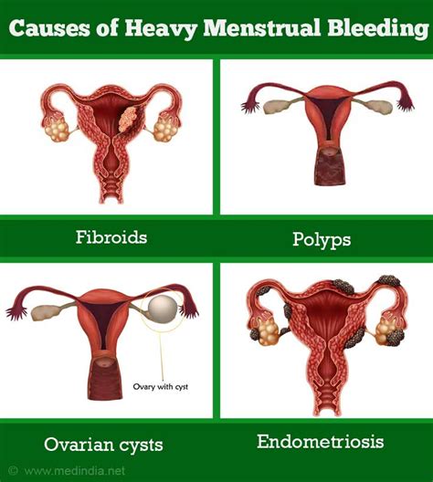 Menstrual Periods Heavy Prolonged Or Irregular Symptom Evaluation