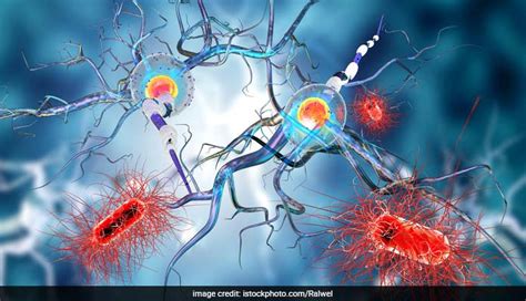 Parkinsons May Begin In Gut Cells Study