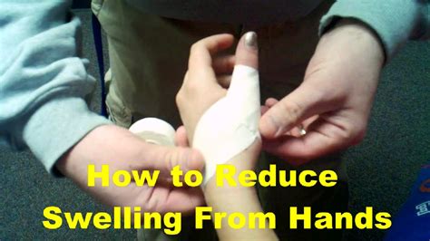 How To Reduce Swelling From Hands Pain Health Recovery Tips For Swollen
