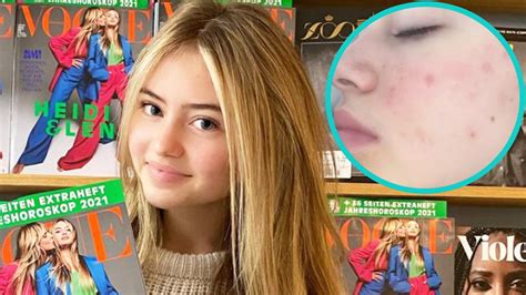 heidi klum s daughter leni gets honest about acne in close up selfie this too shall pass access