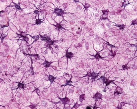 Astrocytes Light Micrograph Stock Image C0517244 Science Photo