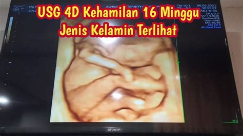 Usg 4d Kehamilan 16 Minggu Jenis Kelamin Janin Terlihat Youtube