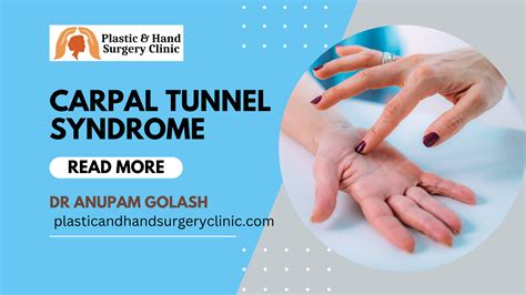 Carpal Tunnel Syndrome Things You Need To Know Plastic And Hand